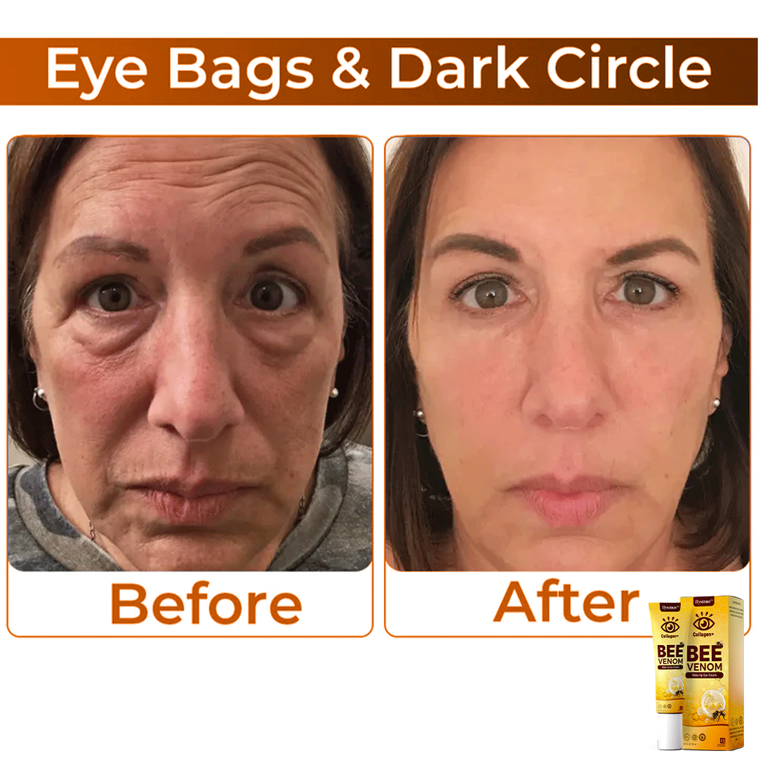 ✨ Ziprino® Collagen+ Bee Venom Wake Up Eye Cream 🇺🇸 Dermatologist Recommended