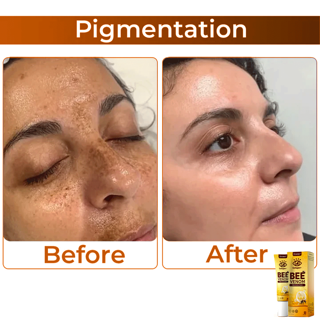 ✨ Ziprino® Collagen+ Bee Venom Wake Up Eye Cream 🇺🇸 Dermatologist Recommended