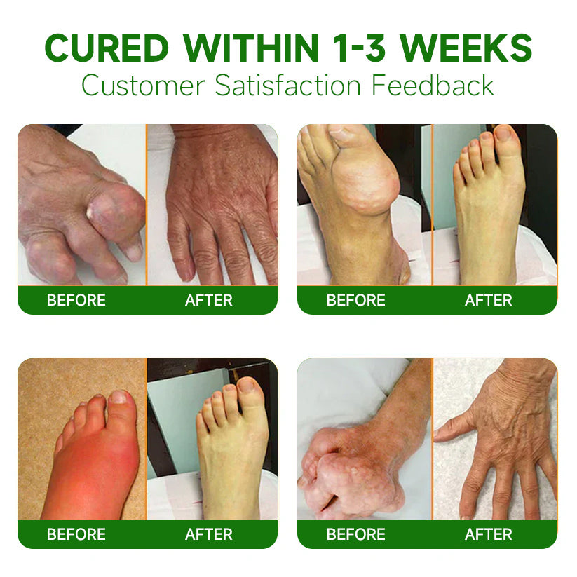 đđ¨ââď¸Ourlyard⢠Extra Strong Hemp Cream(Relieves joint pain and soothes soreness from muscle strains and sprains)