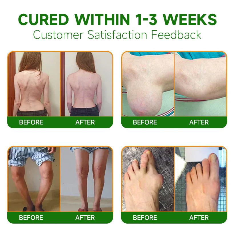 đđ¨ââď¸Ourlyard⢠Extra Strong Hemp Cream(Relieves joint pain and soothes soreness from muscle strains and sprains)
