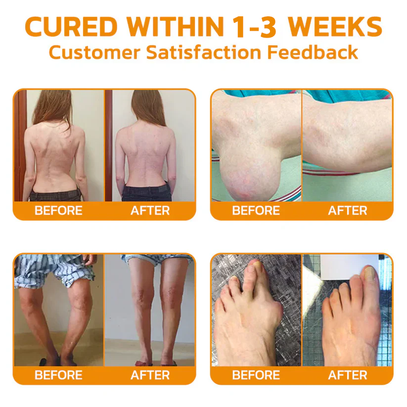 💪👨⚕️The Latest Joint Pain Treatment of 2025! 💧🐝Ourlyard™ Magnesium Oil & Bee Venom Joint Healing Lotion