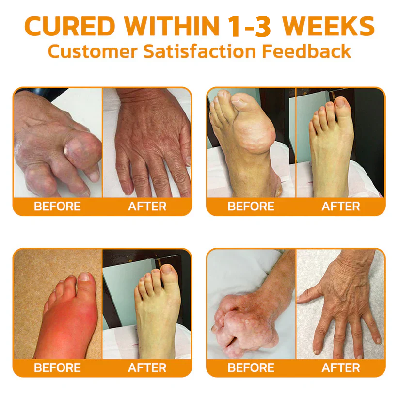 💪👨⚕️The Latest Joint Pain Treatment of 2025! 💧🐝Ourlyard™ Magnesium Oil & Bee Venom Joint Healing Lotion