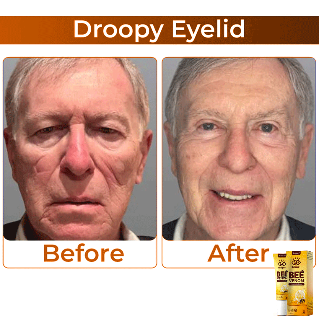 ✨ Ziprino® Collagen+ Bee Venom Wake Up Eye Cream 🇺🇸 Dermatologist Recommended