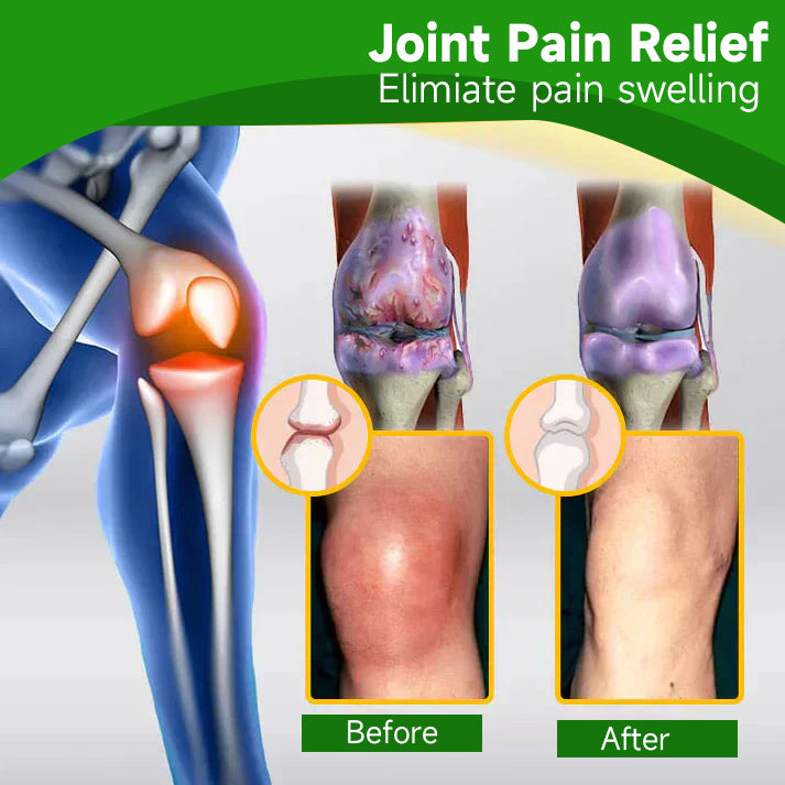 🍀👨‍⚕️Ourlyard™ Extra Strong Hemp Cream(Relieves joint pain and soothes soreness from muscle strains and sprains)