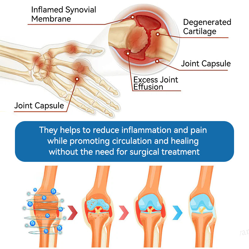 🇦🇺𝐟𝐥𝐲𝐬𝐦𝐮𝐬® 𝐁𝐏𝐂-𝟏𝟓𝟕 𝐉𝐨𝐢𝐧𝐭 𝐇𝐞𝐚𝐥𝐢𝐧𝐠 𝐂𝐫𝐞𝐚𝐦🦴Treats Arthritis, Neuropathy, Rheumatism, Sports Injuries & More🏆