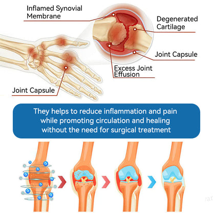 🇦🇺𝐟𝐥𝐲𝐬𝐦𝐮𝐬® 𝐁𝐏𝐂-𝟏𝟓𝟕 𝐉𝐨𝐢𝐧𝐭 𝐇𝐞𝐚𝐥𝐢𝐧𝐠 𝐂𝐫𝐞𝐚𝐦🦴Treats Arthritis, Neuropathy, Rheumatism, Sports Injuries & More🏆