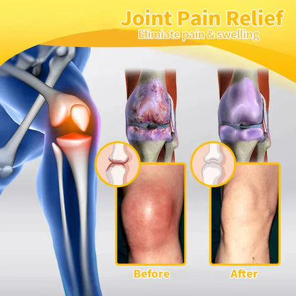💪👨‍⚕️The Latest Joint Pain Treatment of 2025! 💧🐝Ourlyard™ Magnesium Oil & Bee Venom Joint Healing Lotion