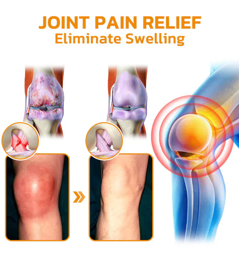💪👨‍⚕️The Latest Joint Pain Treatment of 2025! 💧🐝Ourlyard™ Magnesium Oil & Bee Venom Joint Healing Lotion