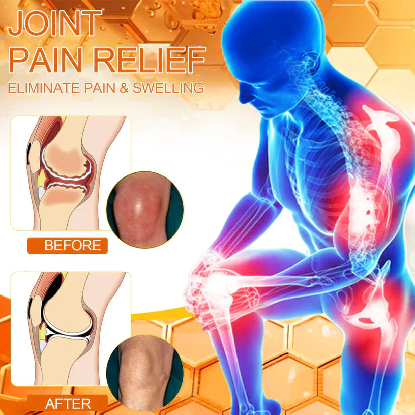 💪👨‍⚕️The Latest Joint Pain Treatment of 2025! 💧🐝Ourlyard™ Magnesium Oil & Bee Venom Joint Healing Lotion