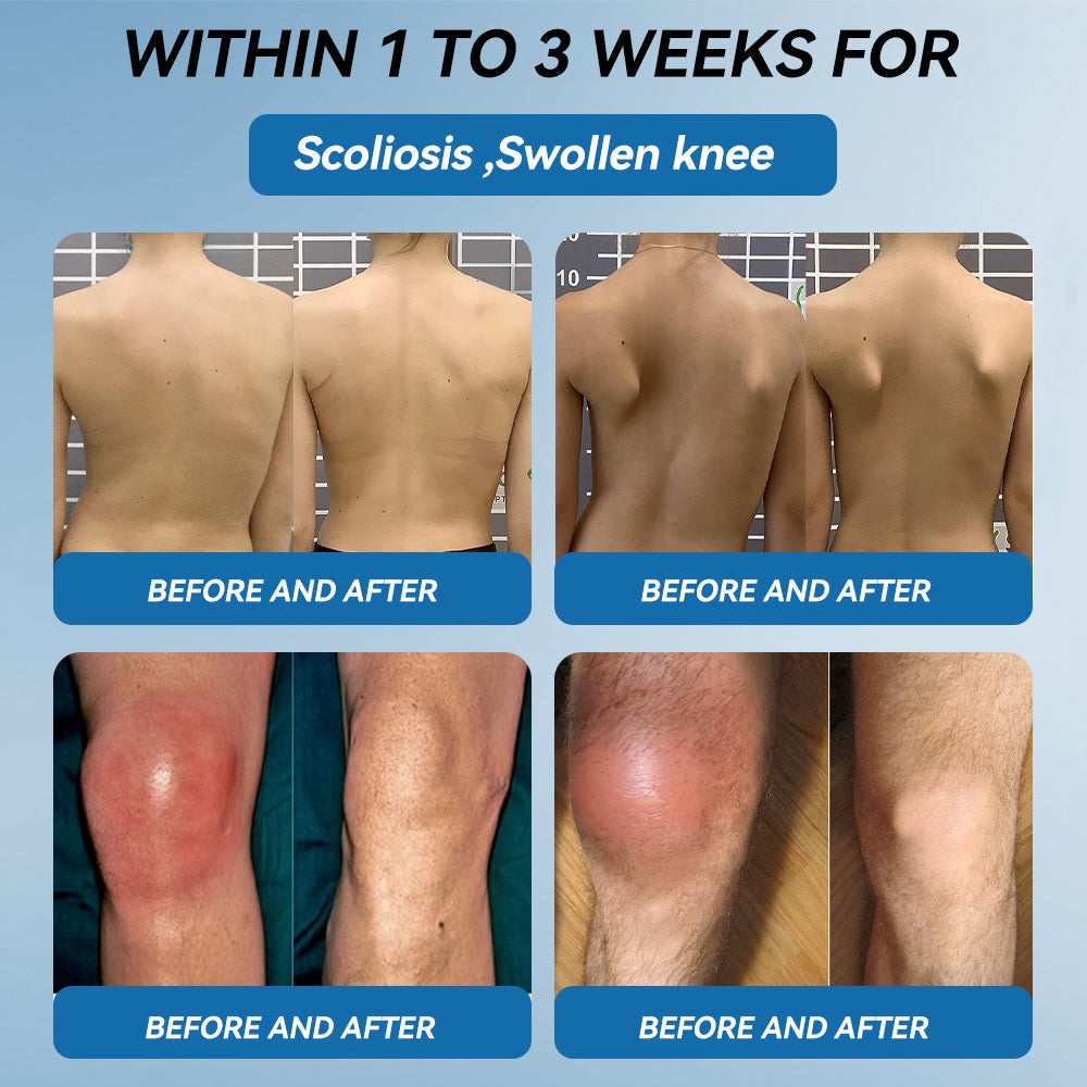 🇦🇺𝐟𝐥𝐲𝐬𝐦𝐮𝐬® 𝐁𝐏𝐂-𝟏𝟓𝟕 𝐉𝐨𝐢𝐧𝐭 𝐇𝐞𝐚𝐥𝐢𝐧𝐠 𝐂𝐫𝐞𝐚𝐦🦴Treats Arthritis, Neuropathy, Rheumatism, Sports Injuries & More🏆