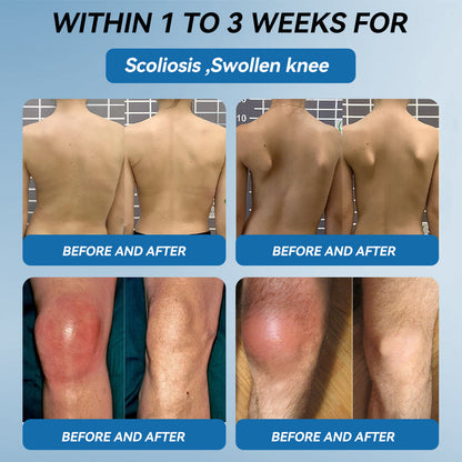 🇦🇺𝐟𝐥𝐲𝐬𝐦𝐮𝐬® 𝐁𝐏𝐂-𝟏𝟓𝟕 𝐉𝐨𝐢𝐧𝐭 𝐇𝐞𝐚𝐥𝐢𝐧𝐠 𝐂𝐫𝐞𝐚𝐦🦴Treats Arthritis, Neuropathy, Rheumatism, Sports Injuries & More🏆