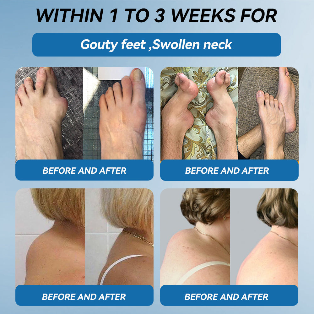 🇦🇺𝐟𝐥𝐲𝐬𝐦𝐮𝐬® 𝐁𝐏𝐂-𝟏𝟓𝟕 𝐉𝐨𝐢𝐧𝐭 𝐇𝐞𝐚𝐥𝐢𝐧𝐠 𝐂𝐫𝐞𝐚𝐦🦴Treats Arthritis, Neuropathy, Rheumatism, Sports Injuries & More🏆