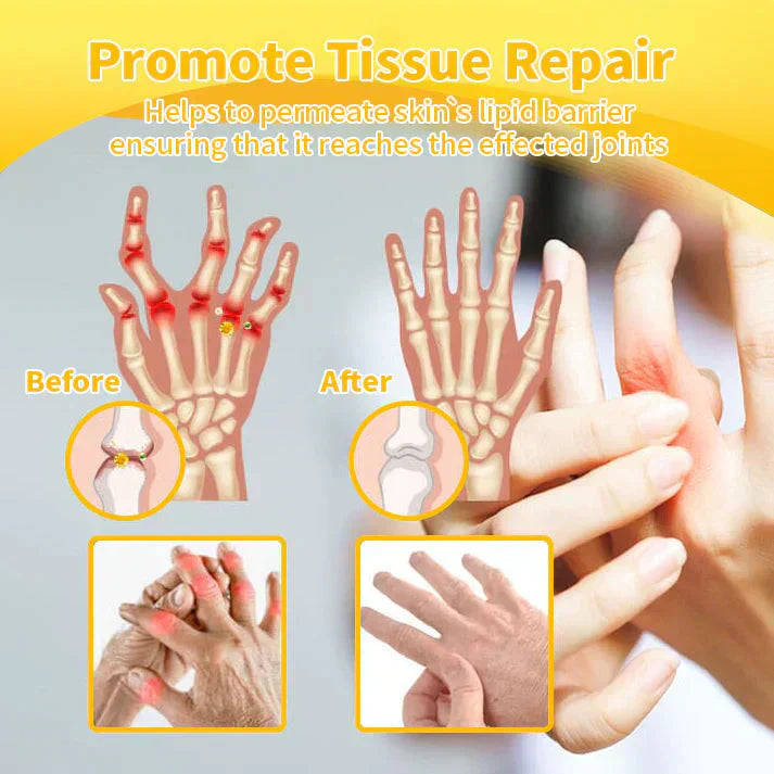 🐝💧Ourlyard™ Magnesium Oil & Bee Venom Joint Healing Spray👨‍⚕️Cure joint pain in just 4 weeks, with no rebound effect