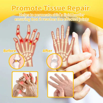 🐝💧Ourlyard™ Magnesium Oil & Bee Venom Joint Healing Spray👨‍⚕️Cure joint pain in just 4 weeks, with no rebound effect