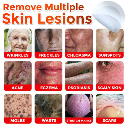 🔥🐨GFOUK® MicroNeedle Botanic Skin Tag Removal Patch ✅Australian Made